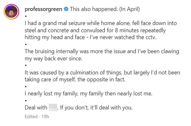 Worrying: He wrote: 'This also happened.  (In April) I had a grand mal seizure while home alone, fell face down on steel and concrete and convulsed for 8 minutes repeatedly hitting my head and face.  I had never seen CCTV.