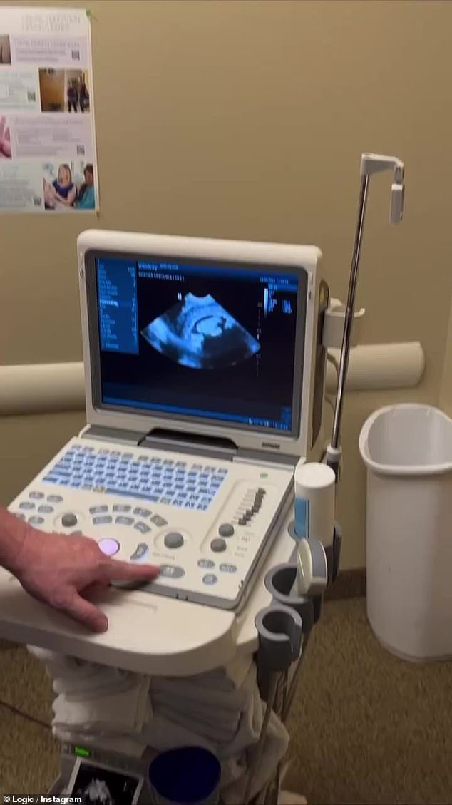 Ultrasound: Her Instagram posts start with a wide shot of the screen at the doctor's office