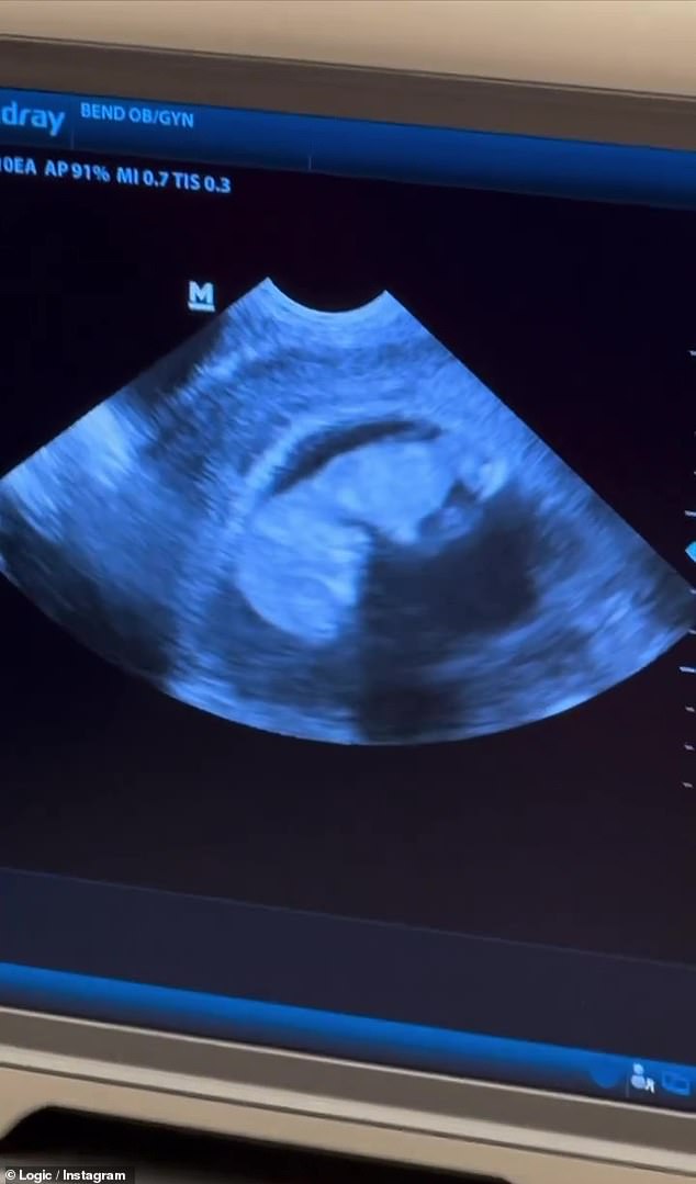 Miracle of life: the camera zooms in for a closer look at the fetus