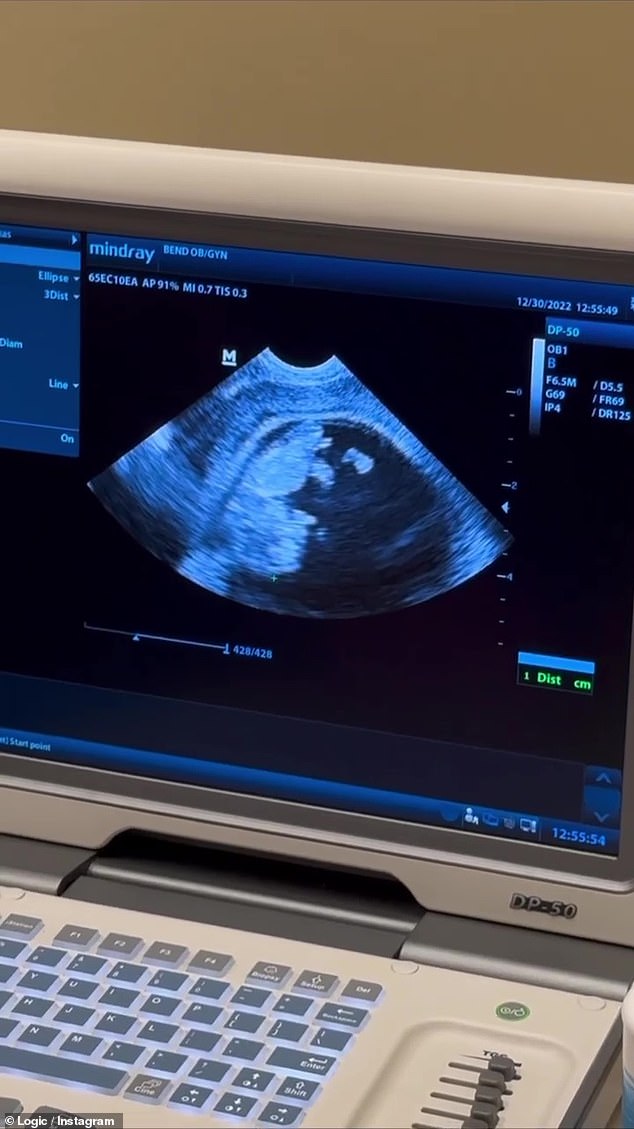 The camera then returns to the video screen to view the ultrasound once more.