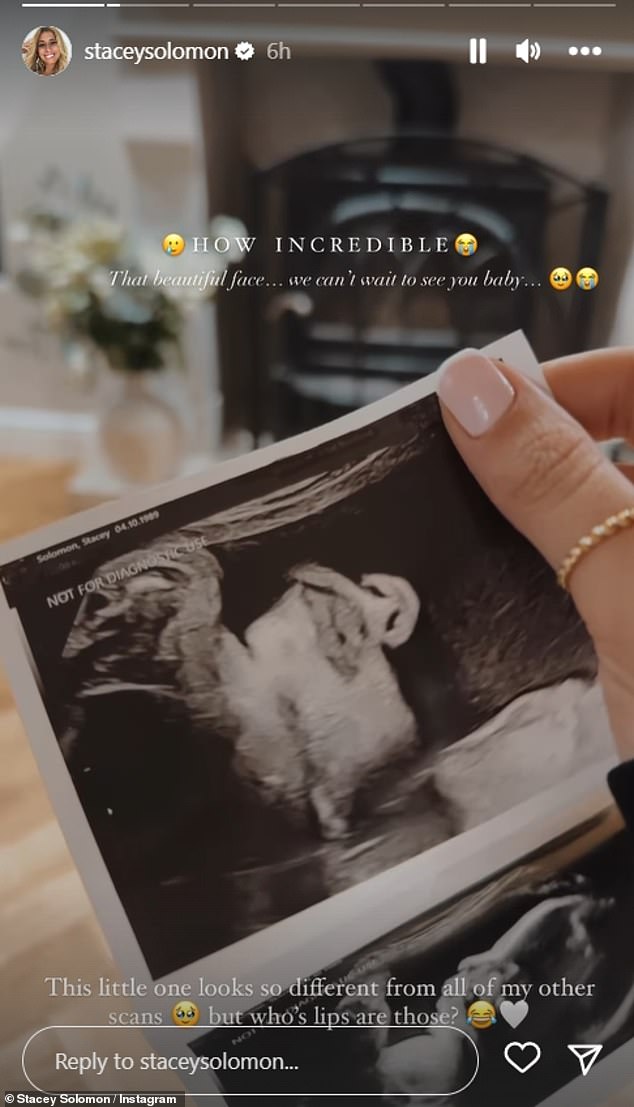 Taking to Instagram on Tuesday, the Loose Women host, 33, who is expecting her fifth child, her third with Joe, uploaded a video of her scan.