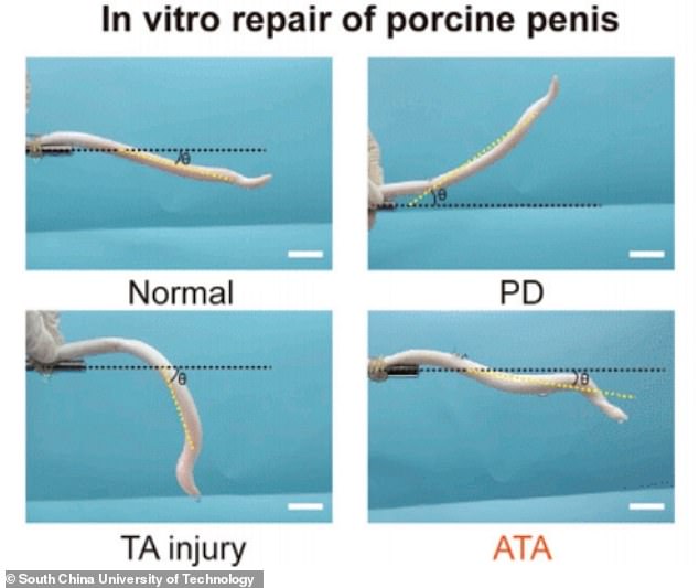 The scientists found that patches made from the artificial tissue (bottom right) restored erectile function to such an extent that it was almost the equivalent of normal penile tissue (top left). Bottom left shows the penis following an