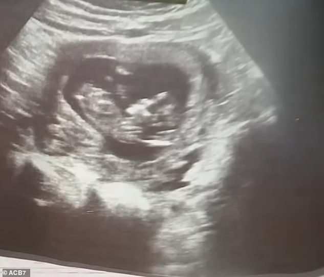 Perez was pregnant with her first child and was due to give birth in June (pictured), her family said.