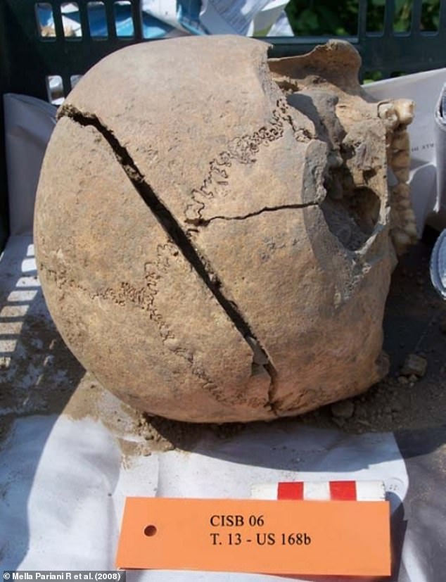 Radiocarbon dating revealed that the victim was buried between 780 and 1260 AD