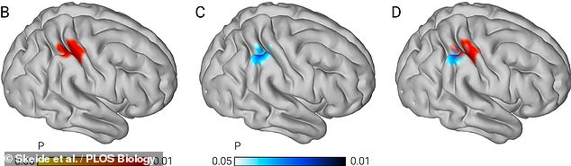 Researchers found that variants in ROBO1 - a gene which regulates the growth of the brain's outmost layer of neural tissue - affect the size of the right parietal cortex. Pictured: Clusters in the right parietal cortex that were found to be associated with the growth gene ROBO1. Red represents data from the first 101 children studied; blue from the replication study with 77 kids