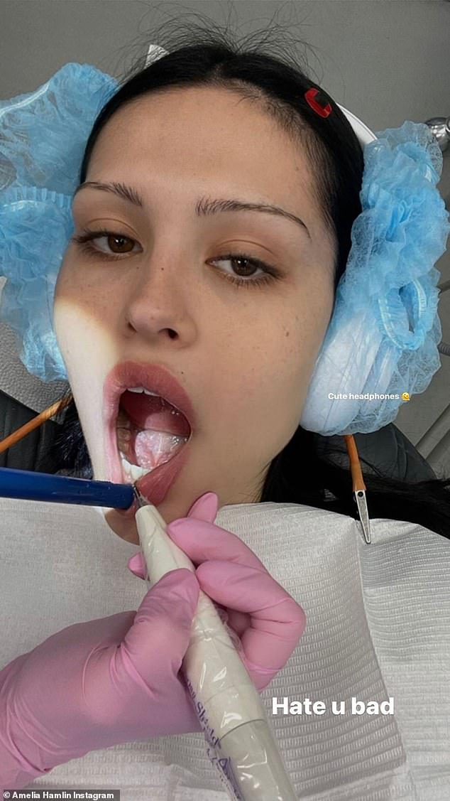 Deep cleaning: Hamlin shared a picture of herself at the dentist on her Instagram story captioned 