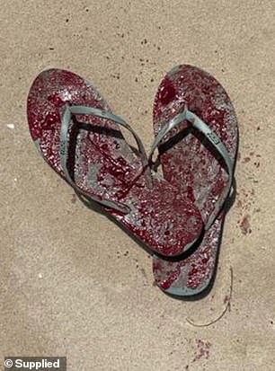 Pictured: Blood Soaked Thongs