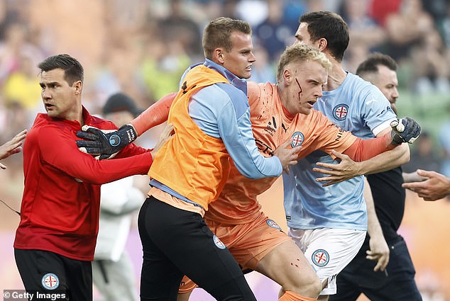 Melbourne City goalkeeper Tom Glover is left bloody and concussed after being hit over the head with a bucket of sand.