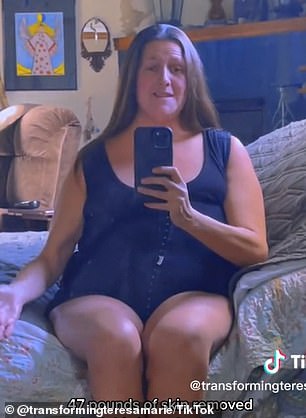 The professor, from California, has been documenting her recovery from her surgery on TikTok