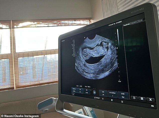 Osaka posted her comments along with an image of an ultrasound of a baby.