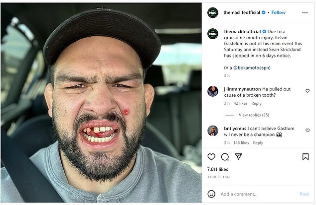 McGregor took aim at former interim UFC middleweight title challenger and The Ultimate Fighter 17 winner Kelvin Gastelum, who posted a photo of himself with an injury to his mouth and what McGregor suspects is a staph infection.