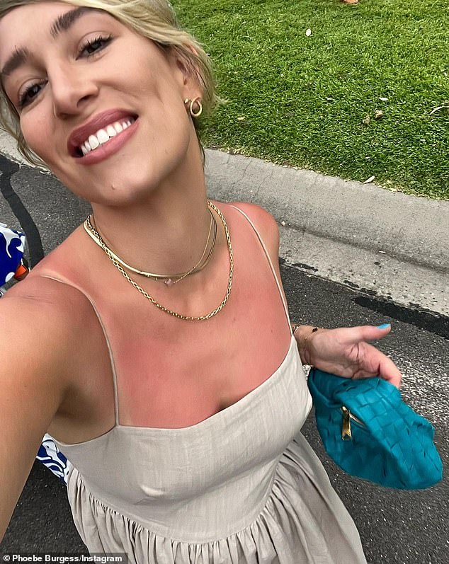 It's not the first time Phoebe has seen herself sunburned on social media, as she had a rather nasty looking sunburn in another set of photos last month.