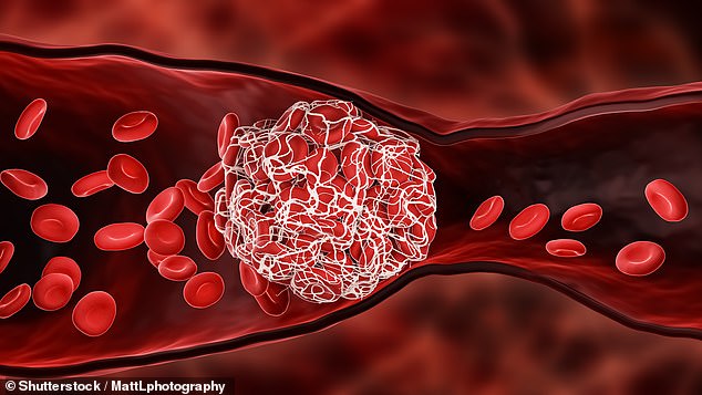 Another reader, a 76-year-old man, reported losing a large amount of blood from his back passage and collapsing ten days after being prescribed rivaroxaban