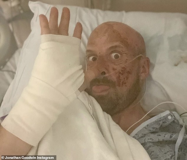 Almost Died Twice: Jonathan, who has now retired from escapology, documented his four months in hospital recovering from injuries including burns and broken legs.