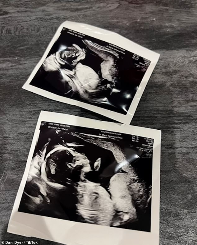 There are two!  Dani shared her ultrasound snapshots with her followers