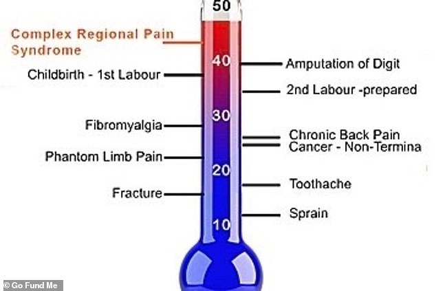 The McGill pain scale measures the pain of CRPS patients as even worse than that of childbirth