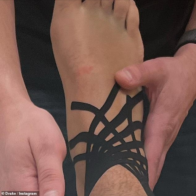 In good hands: Drake shared with fans a photo of his ailing ankle being treated by a doctor