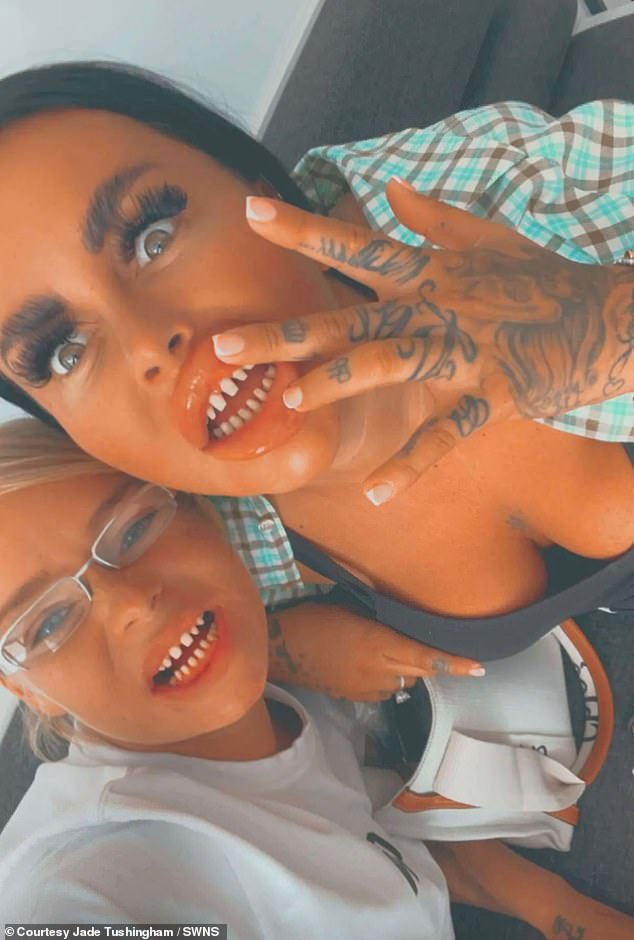 Jade, 32, and her partner Kelly Tushingham, 30, from Chester, Cheshire, who flew to Turkey to get £4k cosmetic veneers on their teeth say it 'ruined their lives', and they were unable to eat or drink (in the photo with his teeth filed)