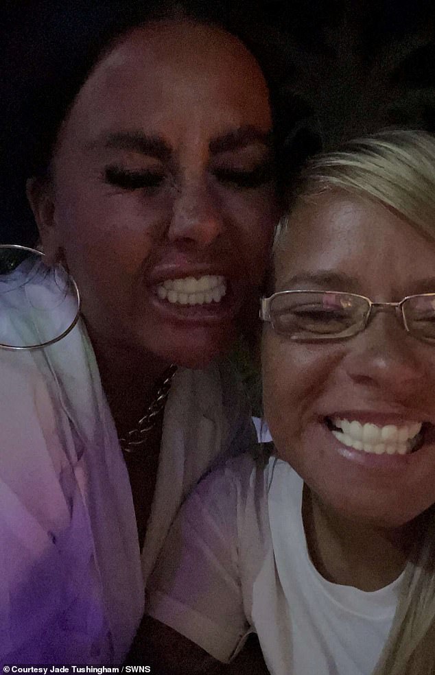 Jade and Kelly took some snaps with their temporary veneers, however they said eating a hot meal followed by a cold drink was 