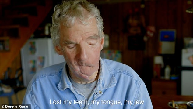 Wes Perkins, 65, of Nome, Alaska, went hunting with his friend Dan Stang, and Dan Stang's son, Edward Stang, in 2011 lost his teeth, tongue and jaw in a vicious attack.