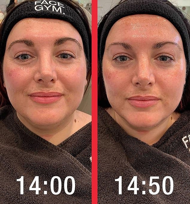 Since FaceGym launched several years ago, it has gone from strength to strength and is now being used by a number of celebrities on the red carpet (pictured before and after)