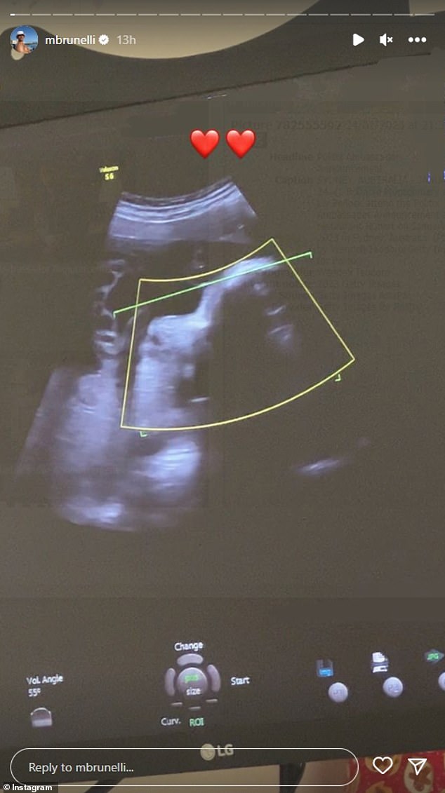 Earlier in the day, she posted a photo of her baby's ultrasound.