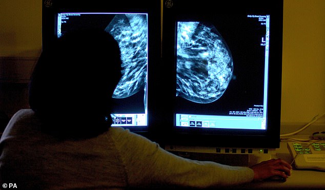 The UK's breast screening programme has the longest gap between screens in the world. In the US it is every one or two years and in Europe every two years