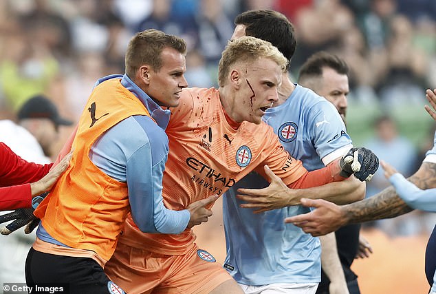 A bleeding Melbourne City Tom Glover is escorted off the pitch by his teammates after fans stormed the pitch at AAMI Park