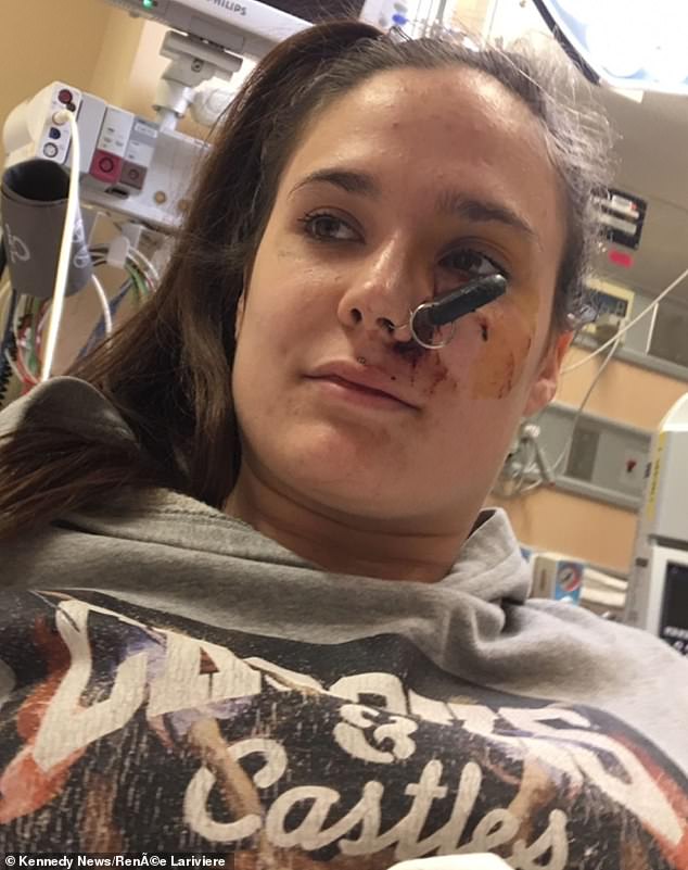 That's bad lock! Car keys end up lodged in Canadian woman's FACE after a  friend tossed them to her