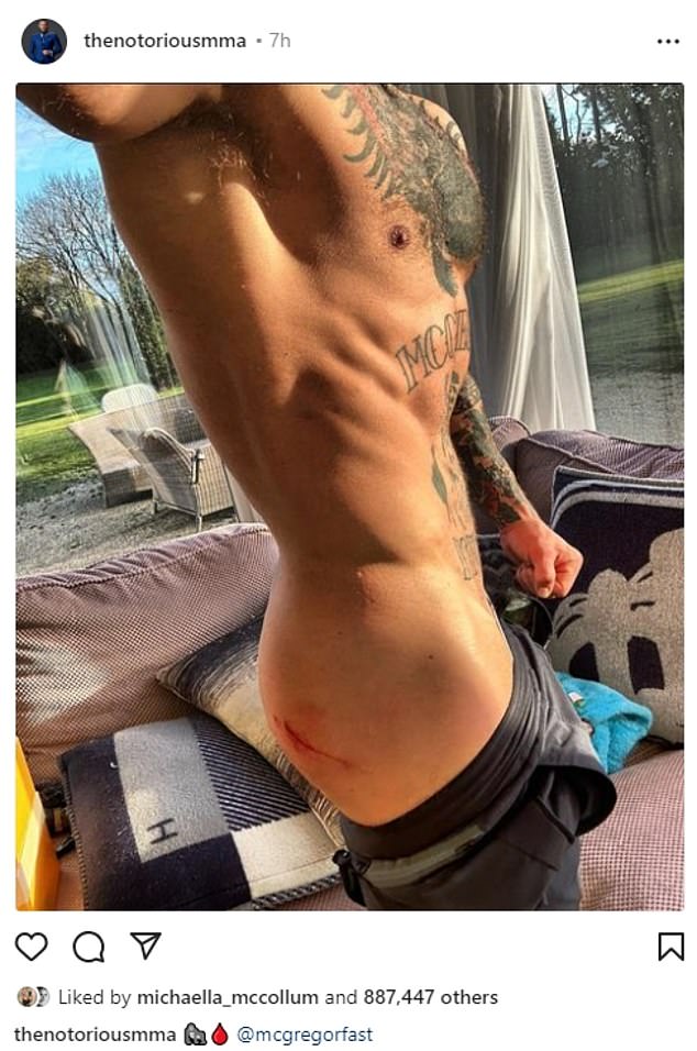 Oh!  The 44-year-old MMA fighter took to Instagram to show fans the large and gruesome cut he sustained on his butt as a result of the incident.