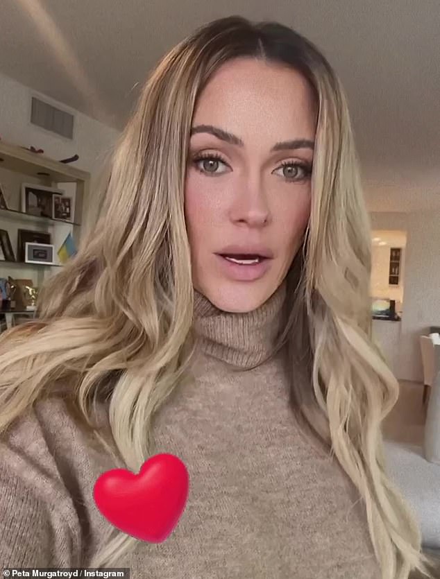 Angelic: Immediately after revealing her acne, Murgatroyd posted a video that filtered out all the bumps and brightened her complexion.  With a heart spinning beneath his angelic features, he talked about filming a Valentine's Day special. 