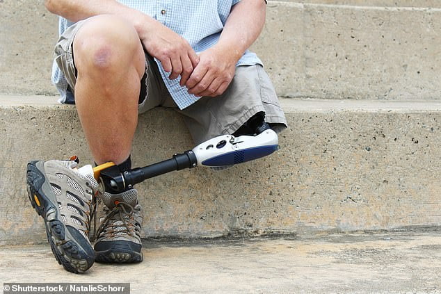 A high-tech bone implant could radically improve the mobility of amputees - as traditional prosthetics can cause sores and pain (file photo)