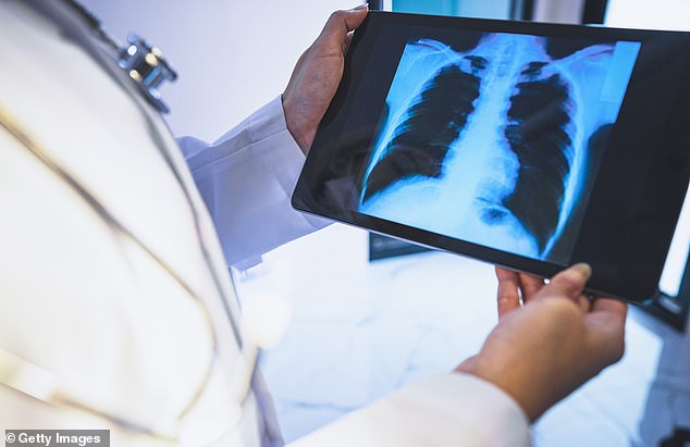 Doctors reviewing x-rays for possible signs of lung cancer can take up to a week to provide a diagnosis, which can harm the patient's long-term prospects