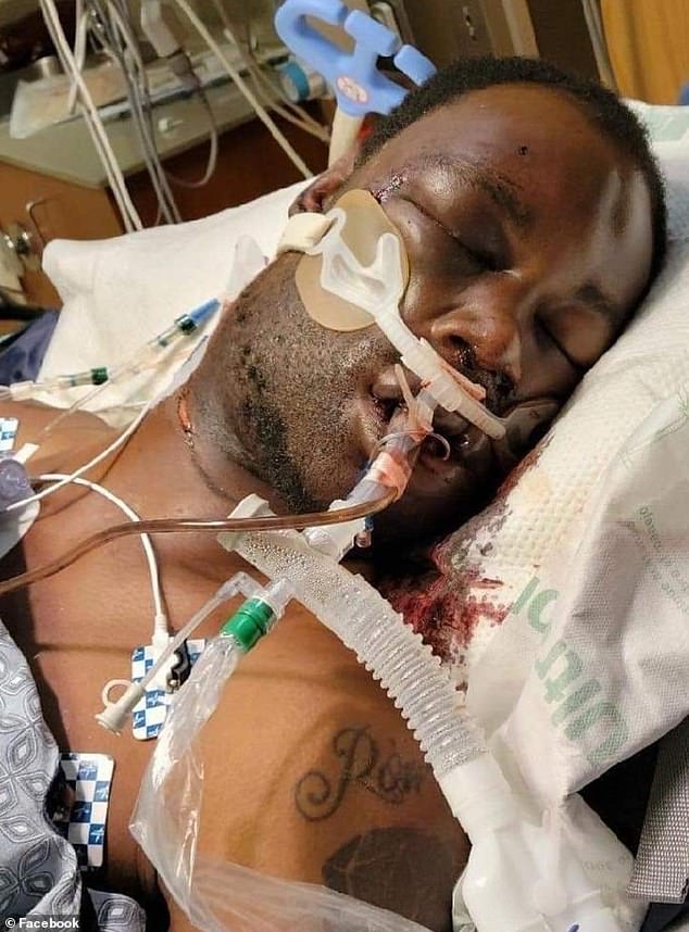 Tire Nichols is shown at the hospital after the incident.  The 29-year-old from Memphis died on January 10 of cardiac arrest and kidney failure, three days after police pulled him over for reckless driving in cars without identification.