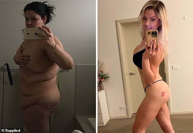 After tipping the scales at 178 kg at the age of 17, Kikii vowed to lose weight - but the results didn't come overnight: It took her the better part of six years to lose 115 kg (253 lbs). ) to fall off.