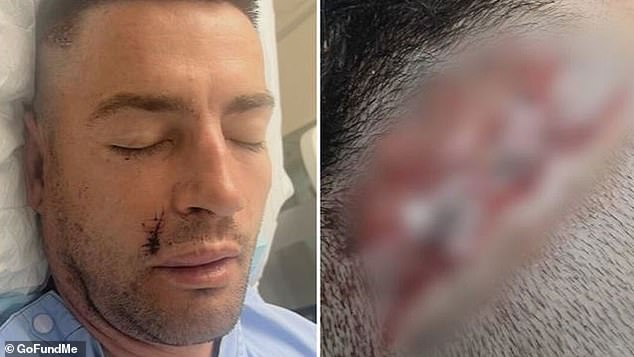 The 36-year-old is now on his eighth day at the Royal Perth Hospital and unsure if his recovery could take days, weeks or months (Photo: Mr Lehr's injuries)