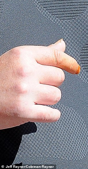 The TV star appears to be in much better health these days, but he still smokes heavily, as evidenced by his heavily stained orange index finger seen on Monday's outing