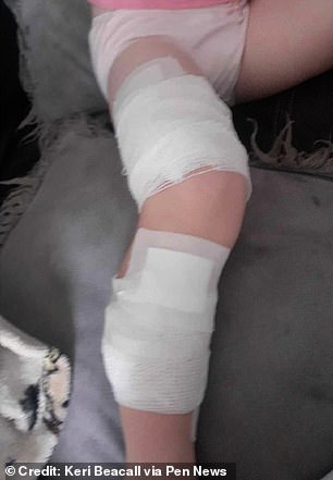 Aurora's legs were bandaged before she was sent home