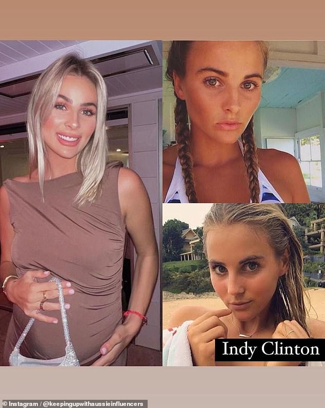 Sydney-based influencer Indy Clinton also appears to have invested in cosmetic injectables.