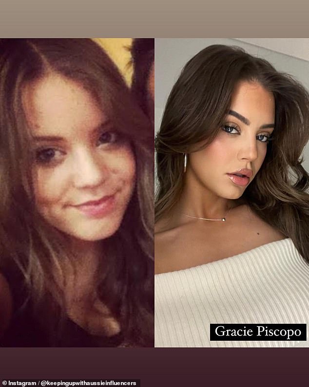 Meanwhile, Gracie Piscopo previously confirmed that she has had lip fillers done and that she also seems to have fuller cheeks these days