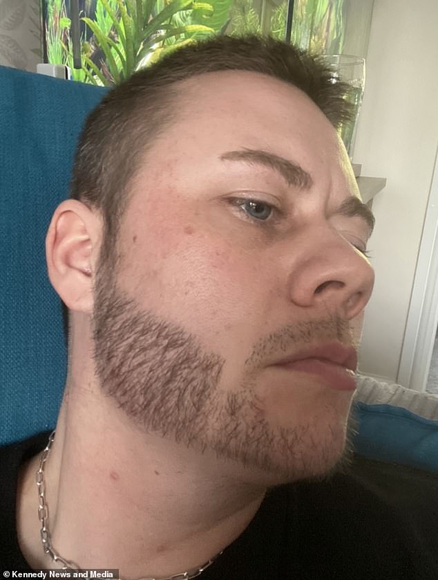 Lee Brown's grown beard.  His own natural facial hair is finally starting to grow, raising hopes that he can actually achieve thick and shiny chops