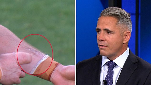 Footy commentator Corey Parker (right) was surprised by the lack of action as there was clear evidence of a mark on Gamble's arm (left)