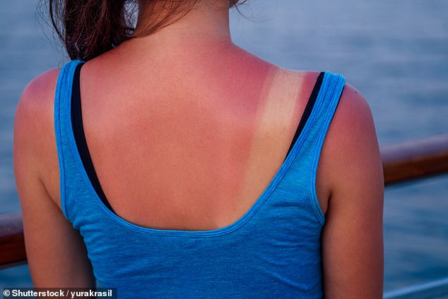 The more often you sunburn, the greater the risk of melanoma skin cancer, experts warn