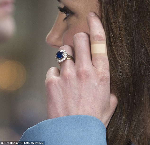 February: disaster strikes Kate again?  The patch comes up on her left index finger 