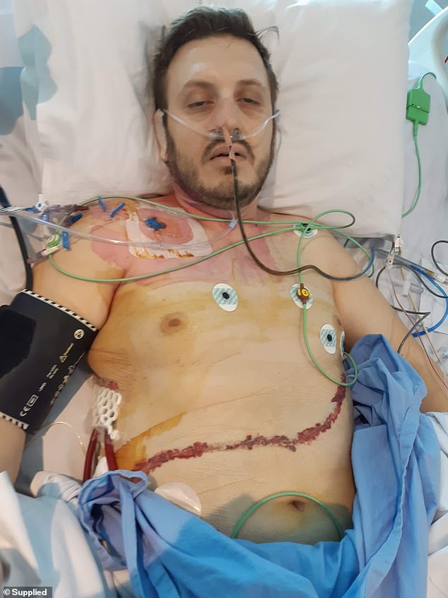 Anthony underwent a six-hour operation at Chris O'Brien Lifehouse in Sydney, where two-thirds of his esophagus and the upper part of his stomach were removed.