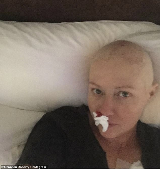 Mourning hair loss: Doherty posted photos of herself bald, following chemotherapy treatments following her initial breast cancer diagnosis