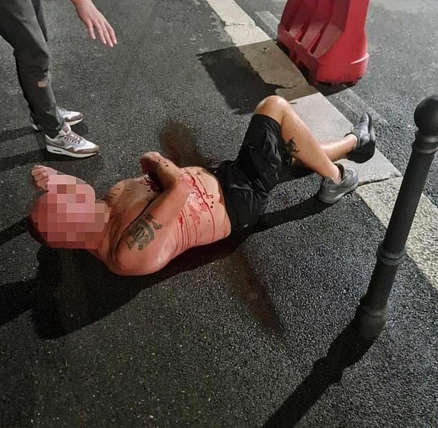 A man with a Newcastle tattoo is seen on the pavement, covered in blood