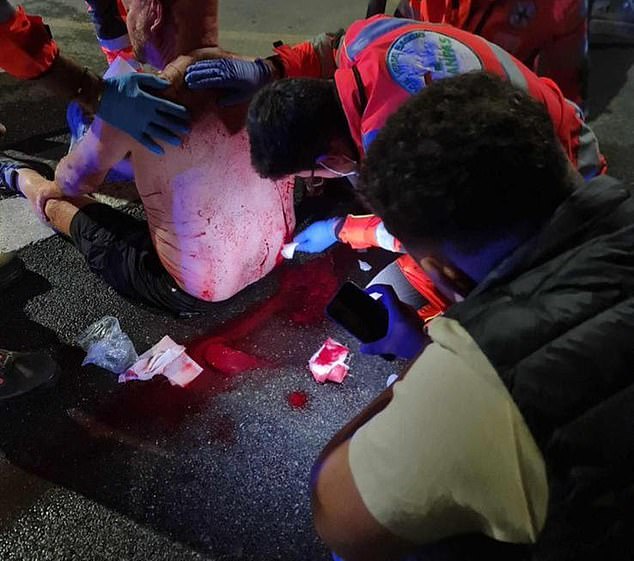 The man is treated for his wounds on the side of the road while medics try to stop the blood