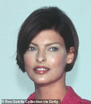 Procedure: The model, pictured in 1995, suffered a rare reaction to the procedure known as CoolSculpting.