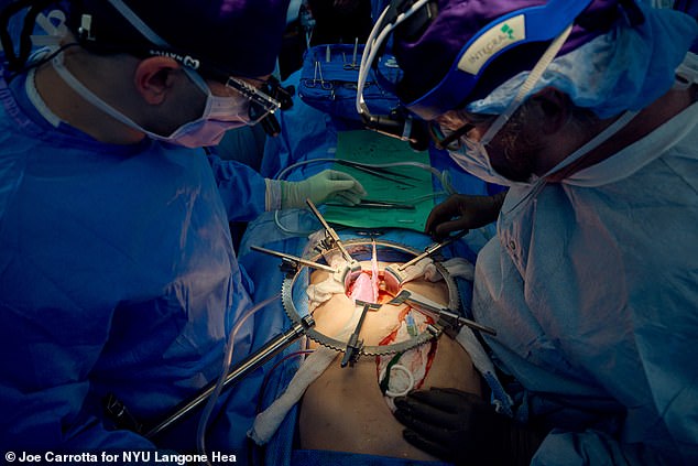 Jeffrey Stern (left) and Robert Montgomery (right) examine the pig kidney moments after blood flow to the organ is restored on July 14